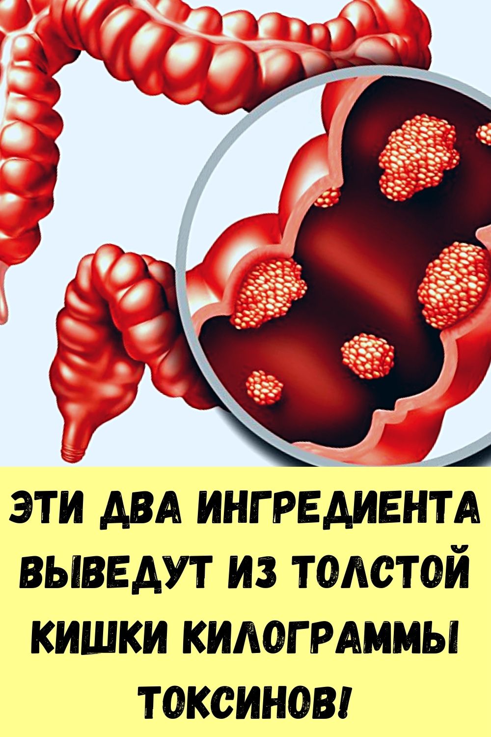 Эти два ингредиента выведут из толстой кишки килограммы токсинов!