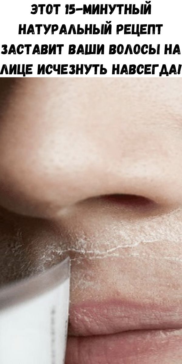 Этот 15-минутный натуральный рецепт заставит ваши волосы на лице исчезнуть навсегда!