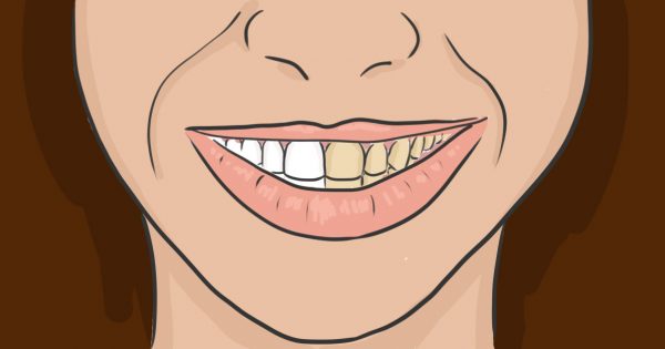 Каждый раз перед тем, как почистить зубы делаю это…
