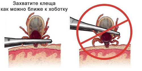 КАК ЗАЩИТИТЬСЯ ОТ КЛЕЩА В ЛЕСУ