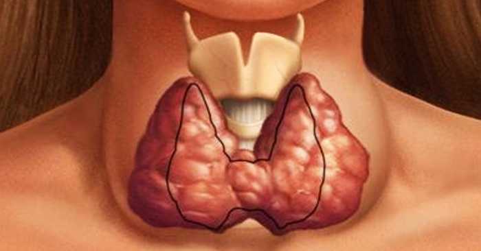 Помоги своей щитовидке быть здоровой! Ешь всего лишь 2 ложки этого волшебного средства!