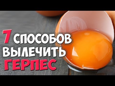 Врачи рекомендуют избавляться от герпеса именно так.